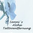 sanni-s-aloha-tattooentfernung