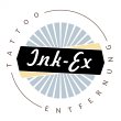 ink-ex-tattooentfernung